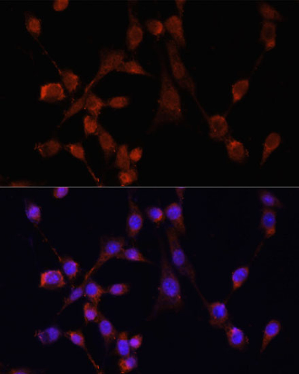 Immunofluorescence analysis of NIH/3T3 cells using MOV10 Polyclonal Antibody at dilution of  1:100. Blue: DAPI for nuclear staining.