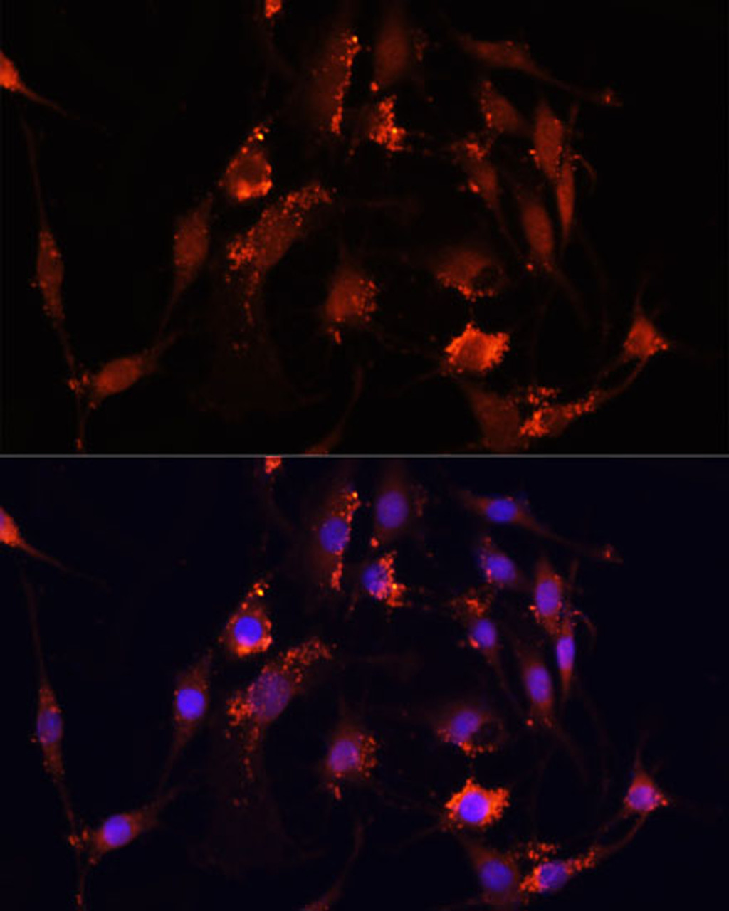 Immunofluorescence analysis of PC12 cells using MOV10 Polyclonal Antibody at dilution of  1:100. Blue: DAPI for nuclear staining.