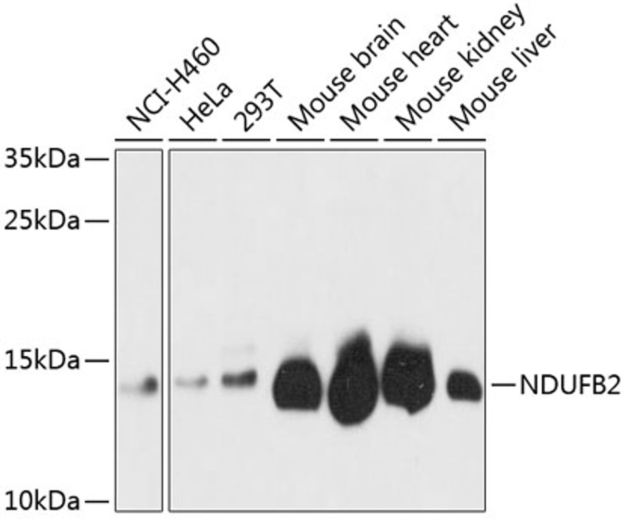 Western blot analysis of extracts of various cell lines using NDUFB2 Polyclonal Antibody at dilution of 1:3000.