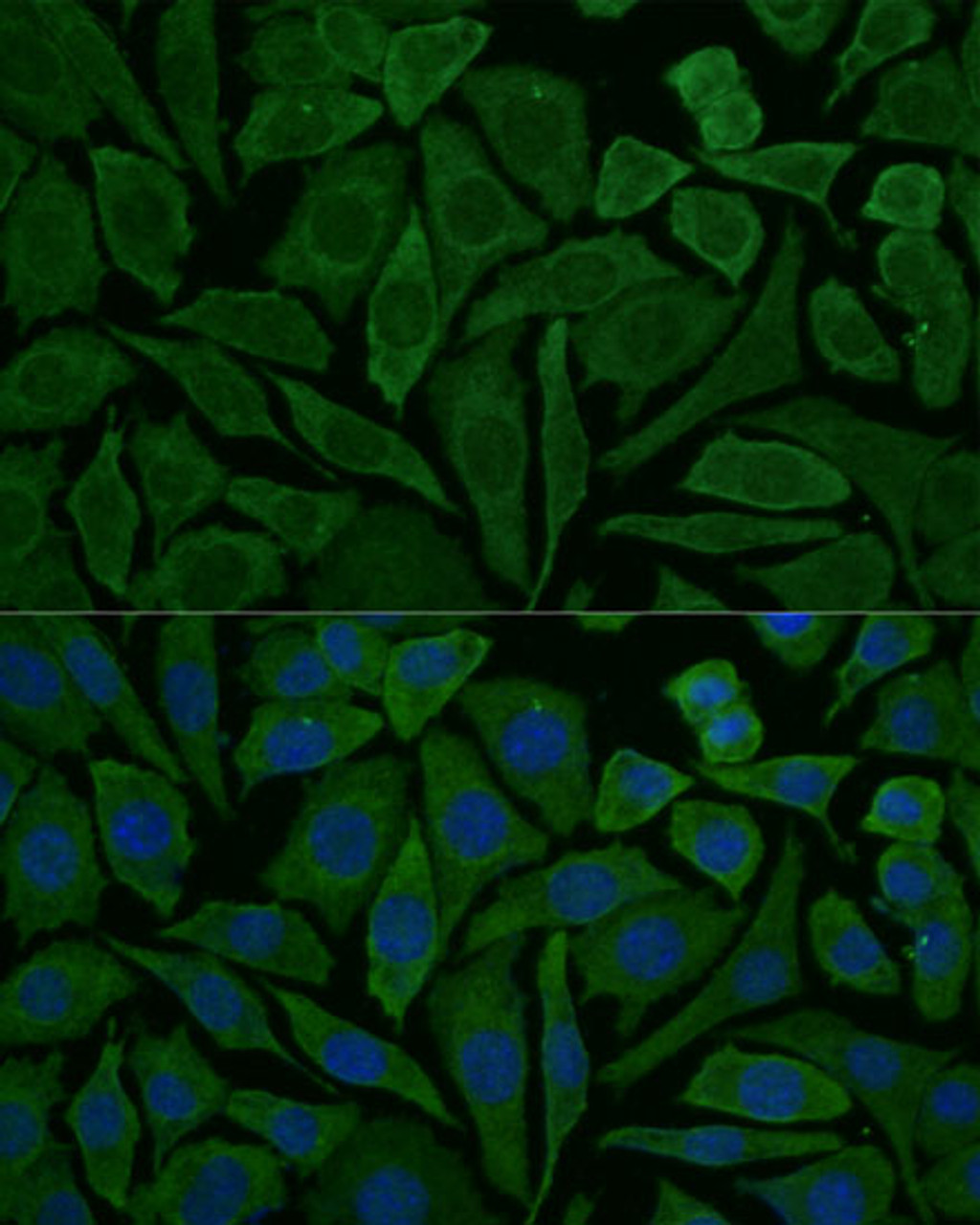 Immunofluorescence analysis of L929 cells using NDUFB2 Polyclonal Antibody at dilution of  1:100 (40x lens). Blue: DAPI for nuclear staining.