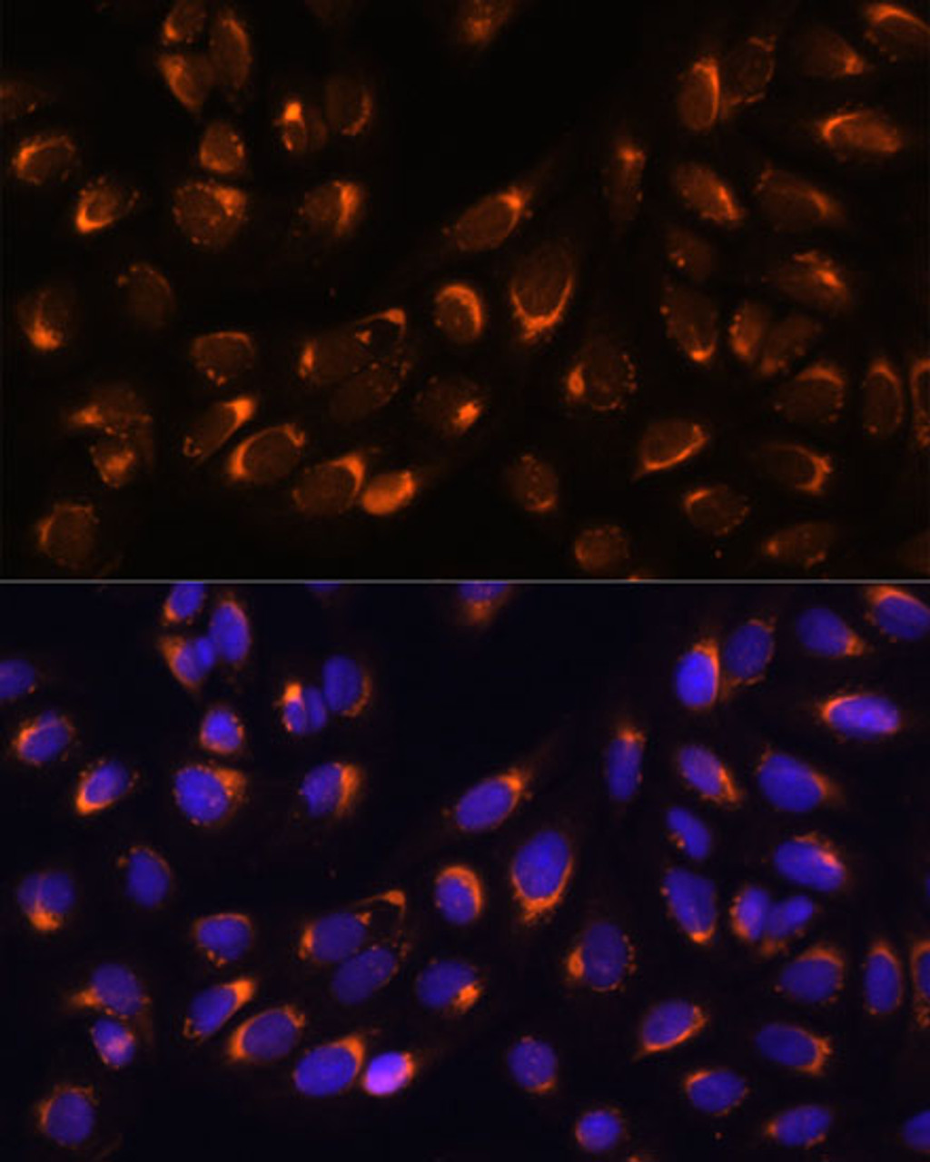 Immunofluorescence analysis of U-2 OS cells using NUCB1 Polyclonal Antibody at dilution of  1:100 (40x lens). Blue: DAPI for nuclear staining.
