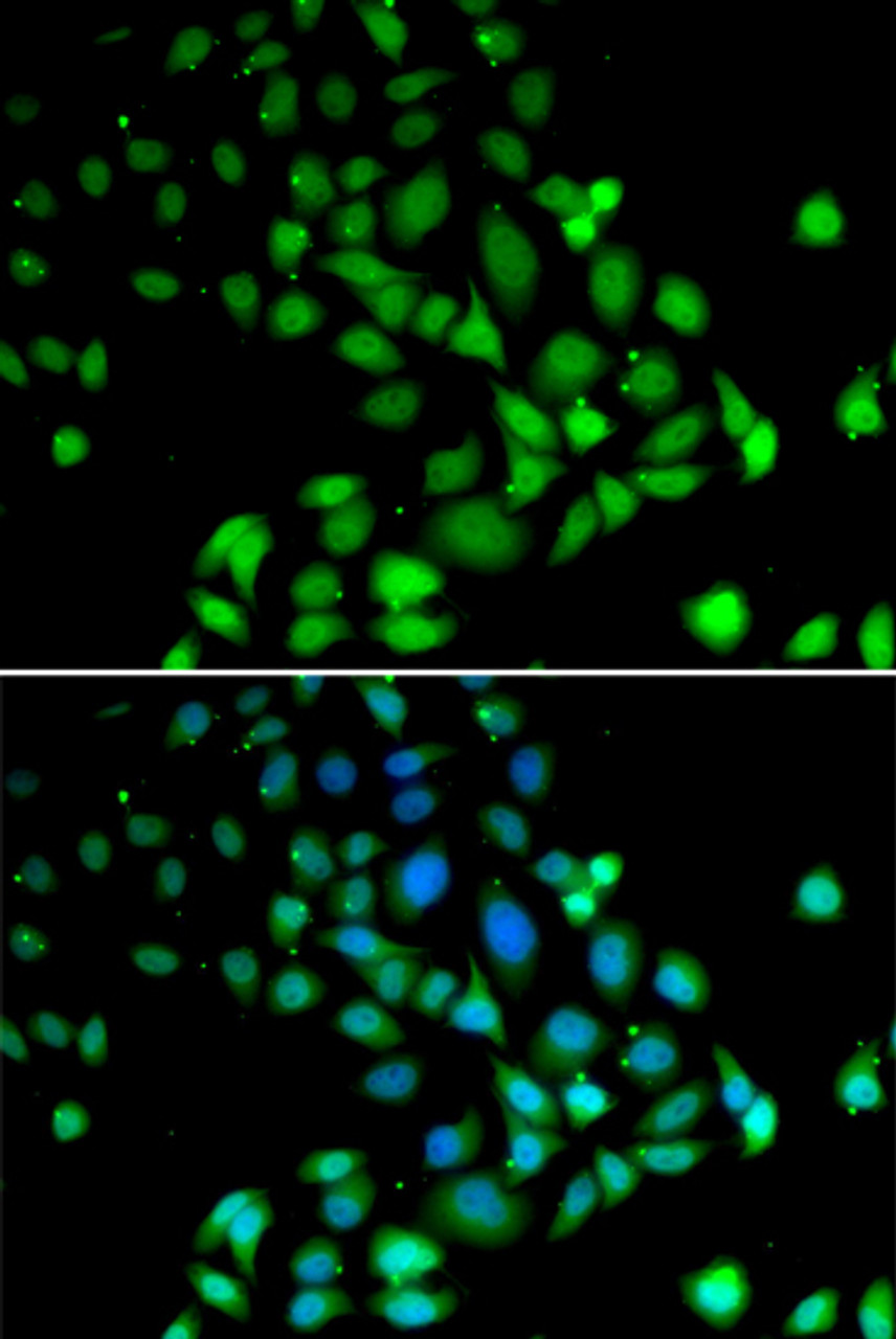 Immunofluorescence analysis of U2OS cells using PARN Polyclonal Antibody