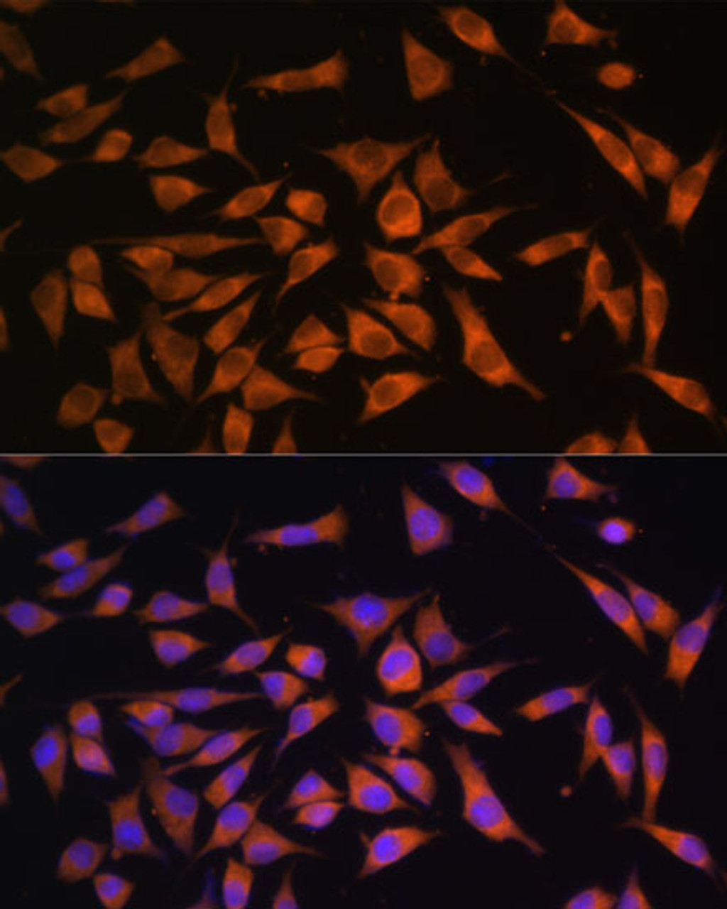 Immunofluorescence analysis of L929 cells using PMM2 Polyclonal Antibody at dilution of  1:100. Blue: DAPI for nuclear staining.