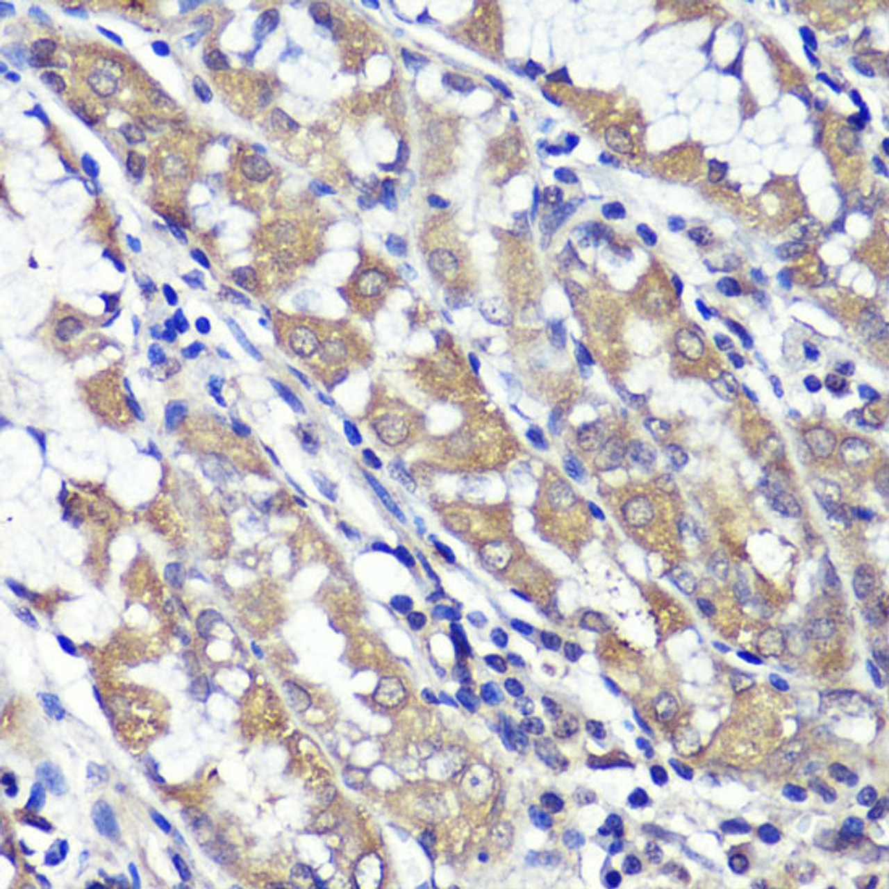 Immunohistochemistry of paraffin-embedded Human stomach using UBL3 Polyclonal Antibody at dilution of  1:100 (40x lens).