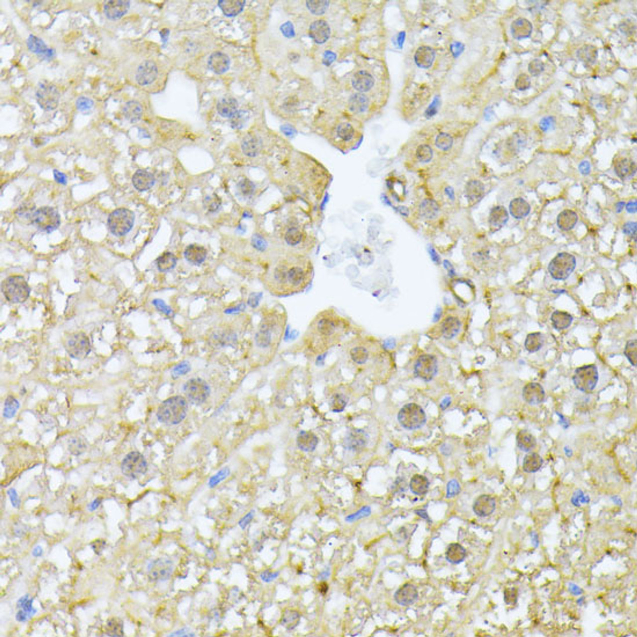 Immunohistochemistry of paraffin-embedded Mouse liver using PSMA7 Polyclonal Antibody at dilution of  1:100 (40x lens).