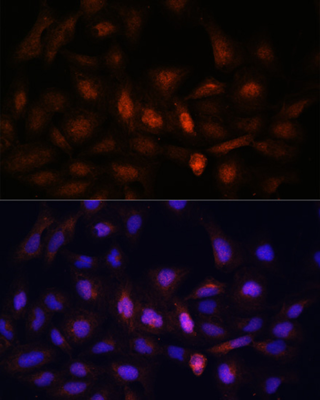 Immunofluorescence analysis of U-2 OS cells using PSMA7 Polyclonal Antibody at dilution of  1:100. Blue: DAPI for nuclear staining.