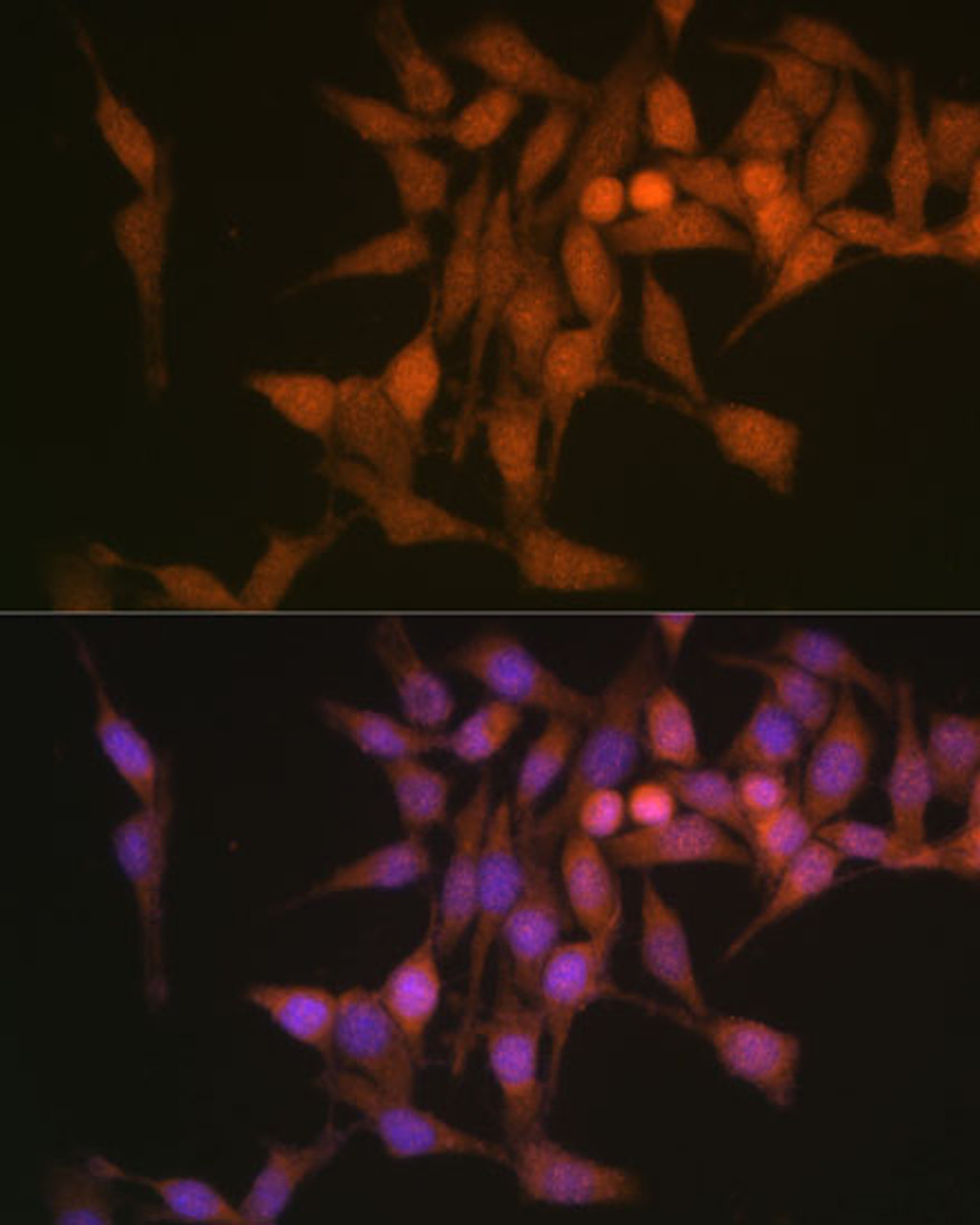 Immunofluorescence analysis of HeLa cells using PSMB6 Polyclonal Antibody at dilution of  1:100 (40x lens). Blue: DAPI for nuclear staining.