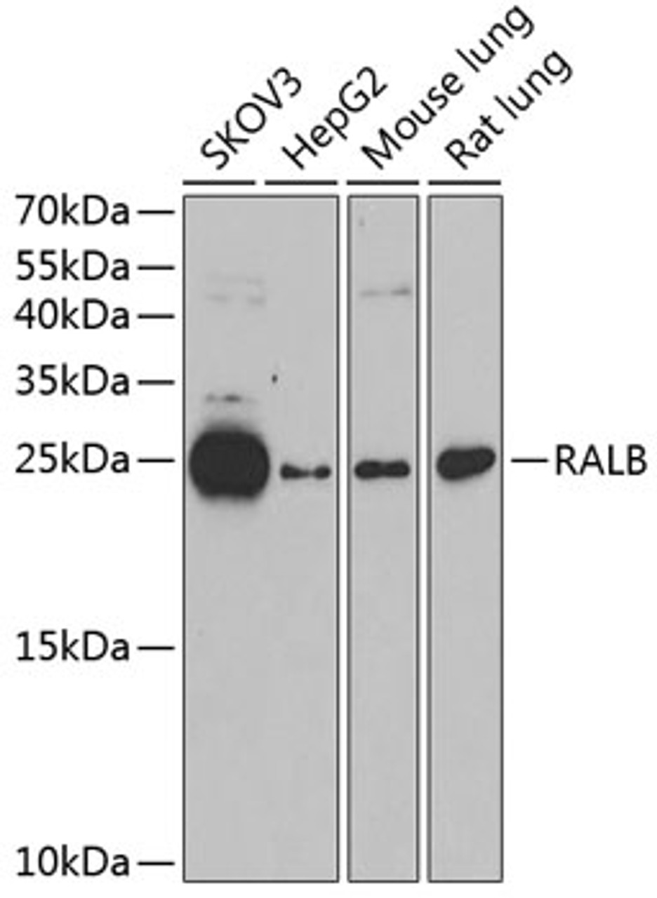 Western blot analysis of extracts of various cell lines using RALB Polyclonal Antibody at dilution of 1:1000.