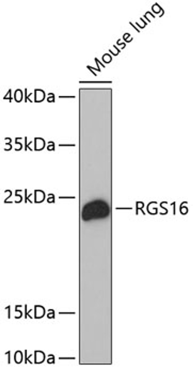 Western blot analysis of extracts of Mouse lung using RGS16 Polyclonal Antibody at dilution of 1:1000.