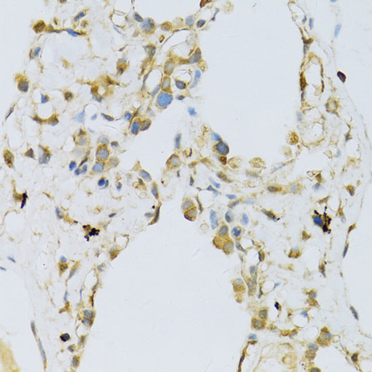 Immunohistochemistry of paraffin-embedded Human lung using RPL13 Polyclonal Antibody at dilution of  1:100 (40x lens).