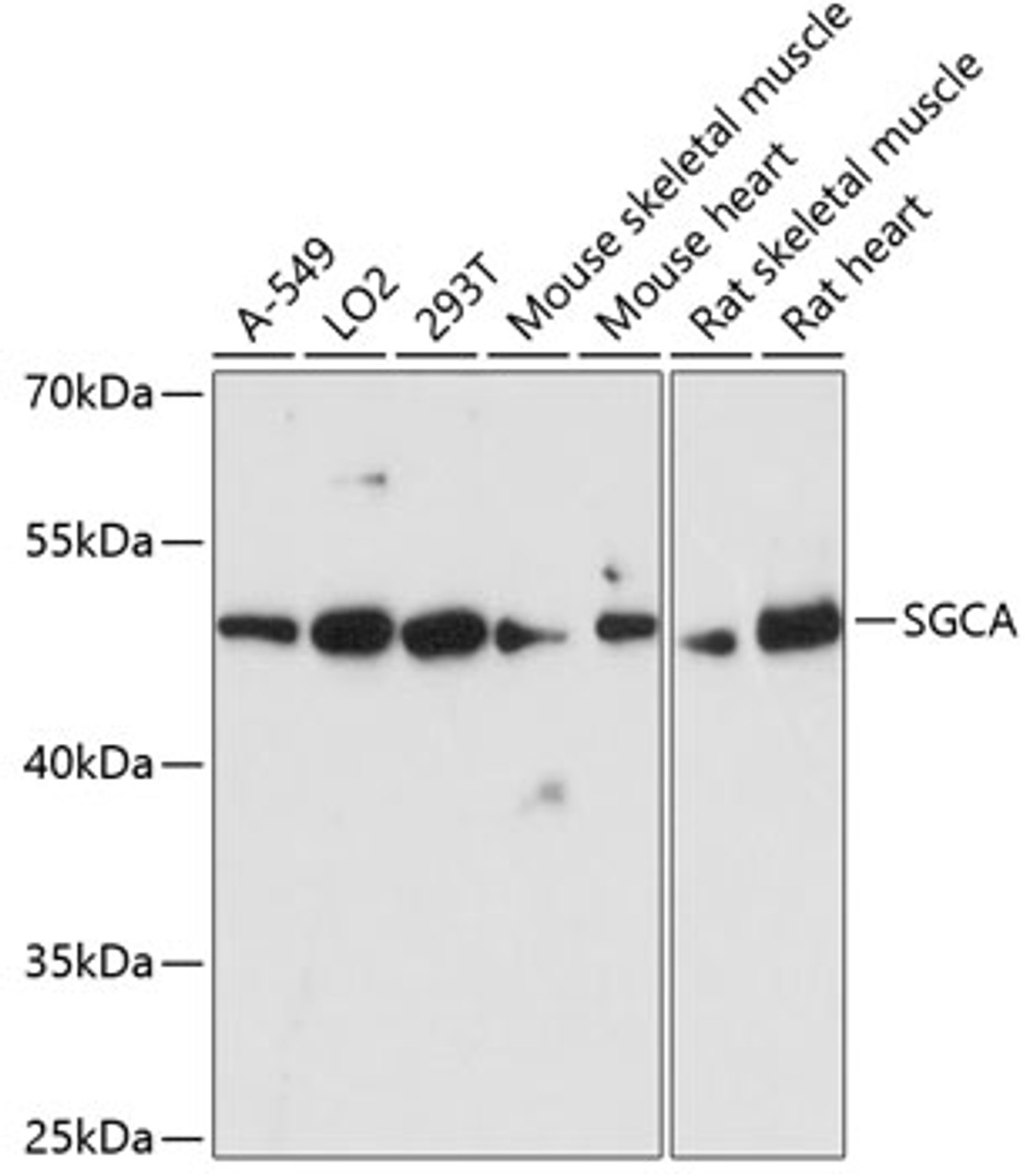 Western blot analysis of extracts of various cell lines using SGCA Polyclonal Antibody at dilution of 1:3000.