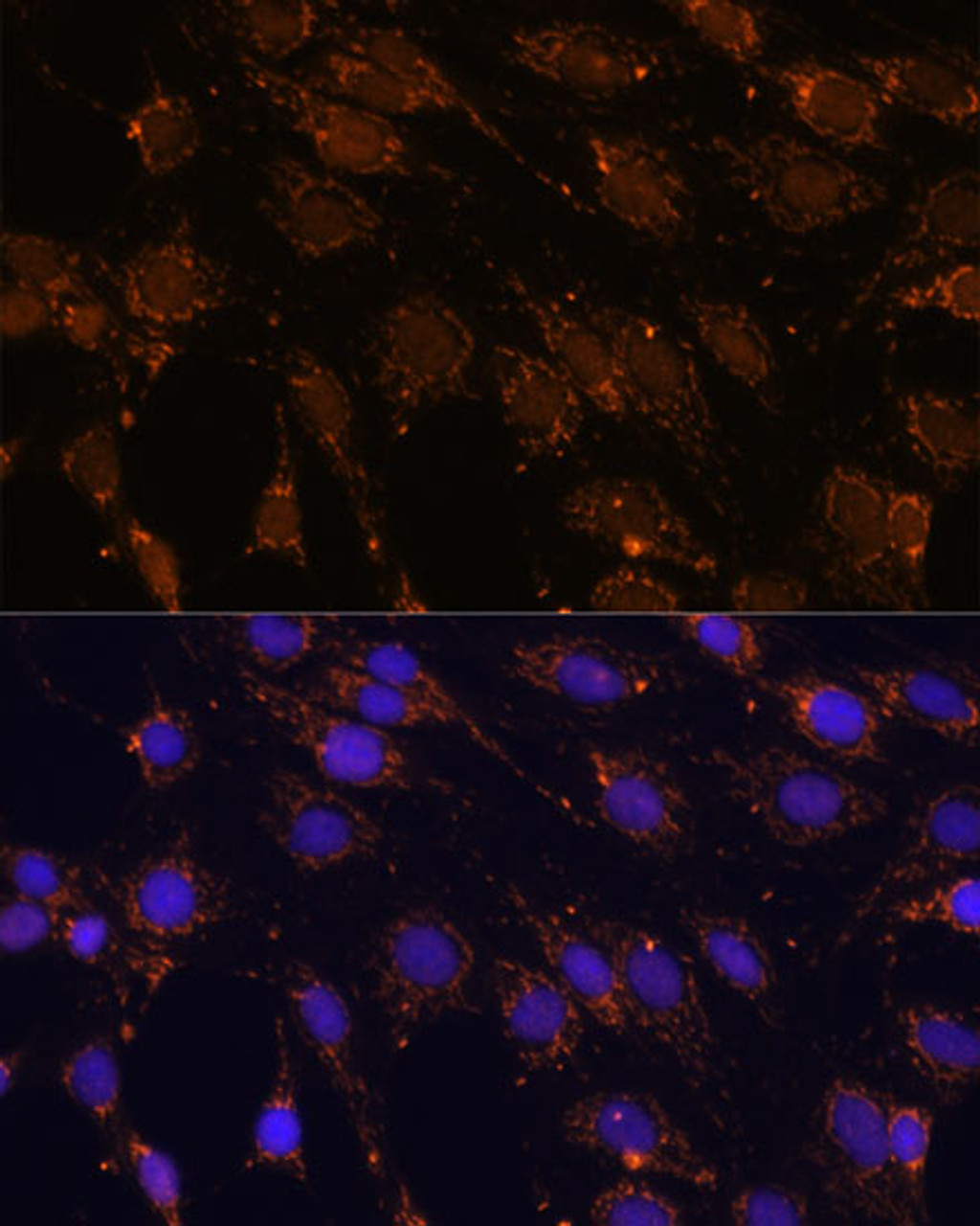 Immunofluorescence analysis of C6 cells using HSPA13 Polyclonal Antibody at dilution of  1:100 (40x lens). Blue: DAPI for nuclear staining.