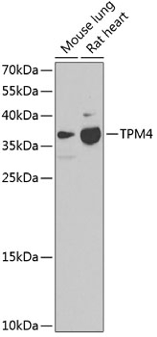 Western blot analysis of extracts of various cell lines using TPM4 Polyclonal Antibody at dilution of 1:1000.