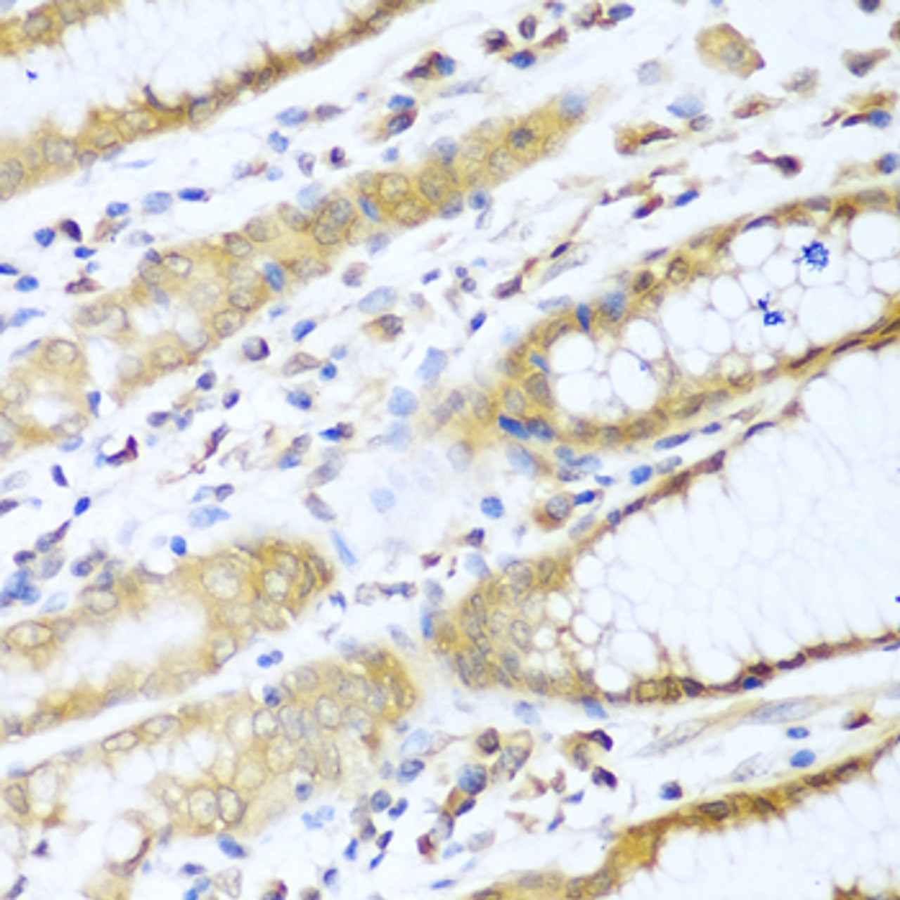 Immunohistochemistry of paraffin-embedded Human stomach using UBE2L3 Polyclonal Antibody at dilution of  1:100 (40x lens).