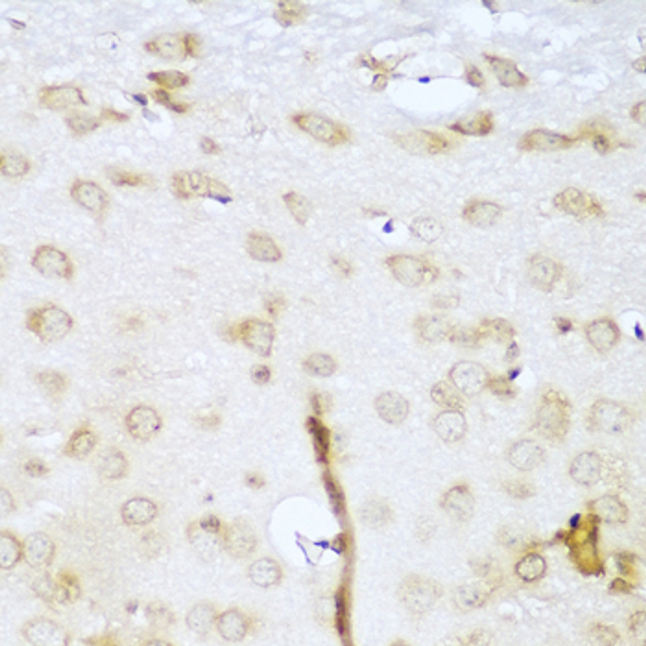 Immunohistochemistry of paraffin-embedded Mouse brain using UBE2L3 Polyclonal Antibody at dilution of  1:100 (40x lens).
