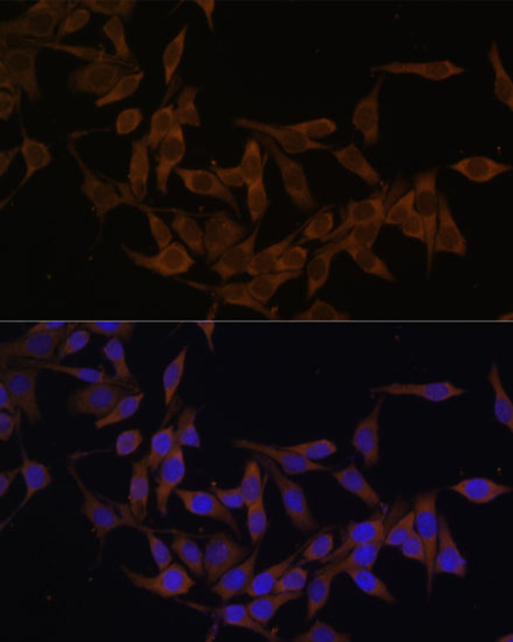 Immunofluorescence analysis of HeLa cells using UBE2L3 Polyclonal Antibody at dilution of  1:100 (40x lens). Blue: DAPI for nuclear staining.