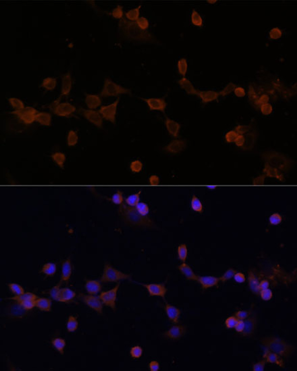 Immunofluorescence analysis of NIH-3T3 cells using UBE2L3 Polyclonal Antibody at dilution of  1:100 (40x lens). Blue: DAPI for nuclear staining.