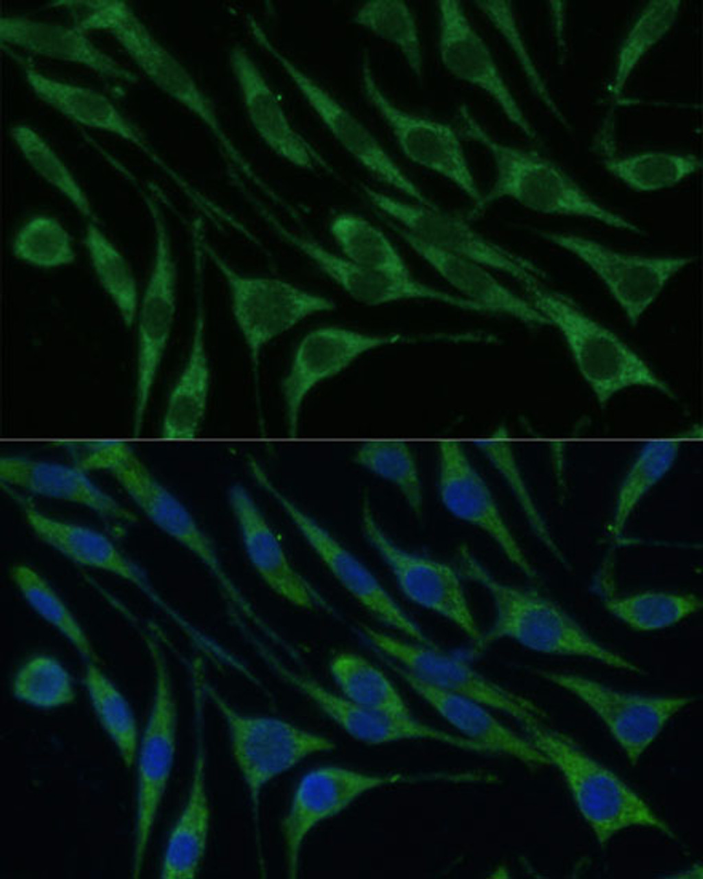 Immunofluorescence analysis of L929 cells using VARS Polyclonal Antibody at dilution of  1:100 (40x lens). Blue: DAPI for nuclear staining.