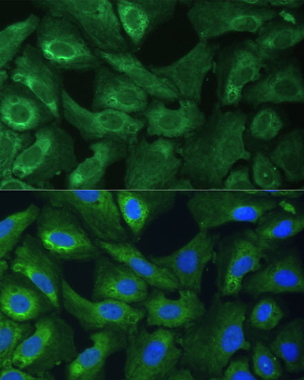 Immunofluorescence analysis of U-2 OS cells using EIF3G Polyclonal Antibody at dilution of  1:100 (40x lens). Blue: DAPI for nuclear staining.