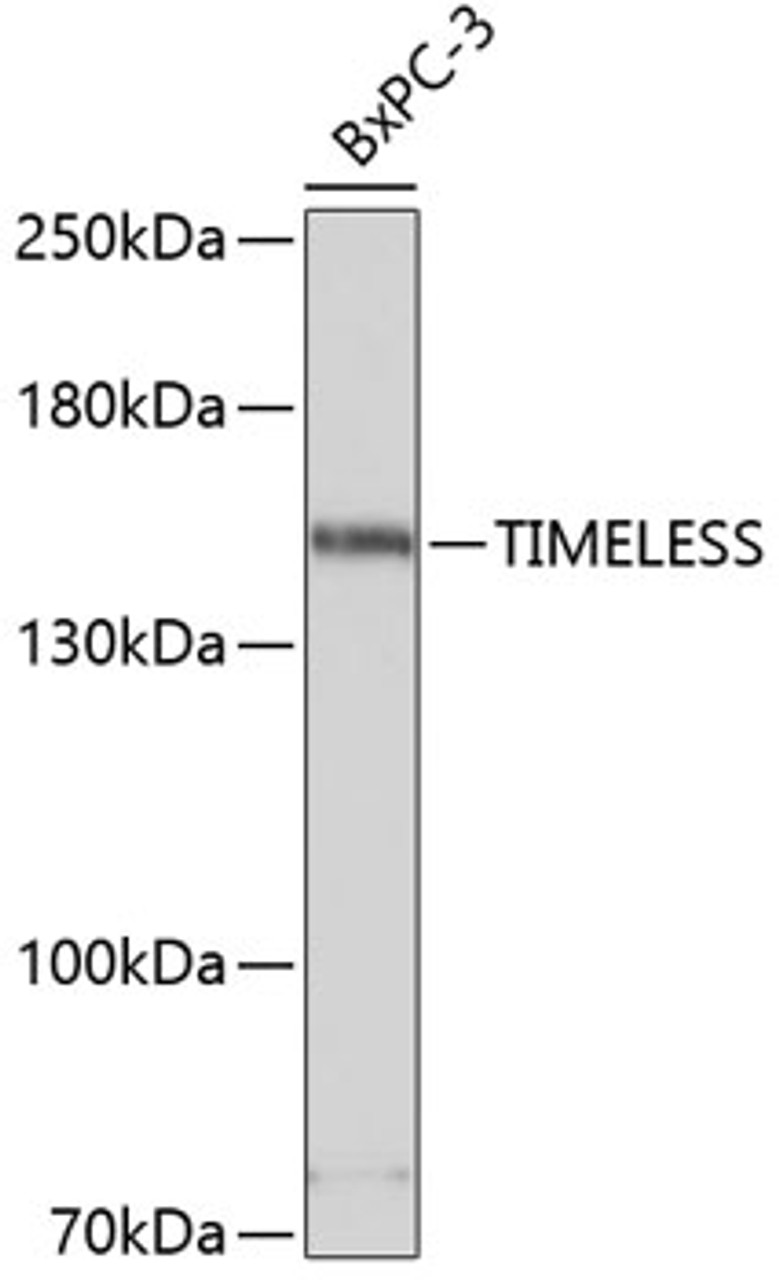Western blot analysis of extracts of BxPC-3 cells using TIMELESS Polyclonal Antibody at dilution of 1:3000.