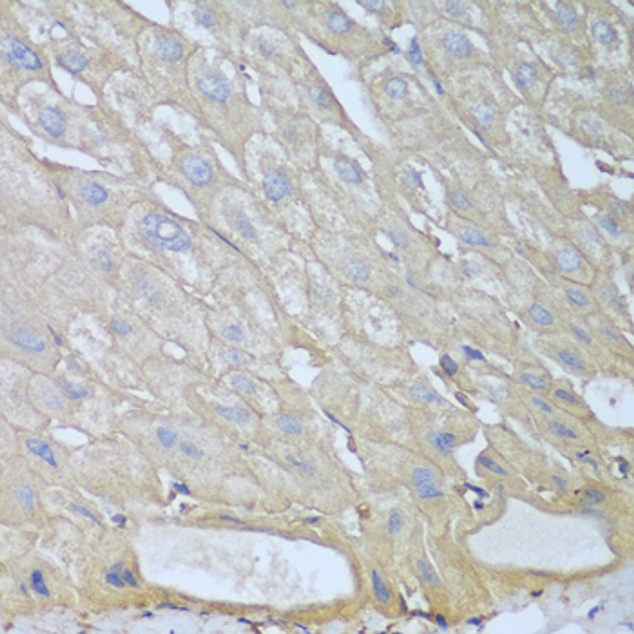 Immunohistochemistry of paraffin-embedded Human liver using RPH3AL Polyclonal Antibody at dilution of  1:100 (40x lens).