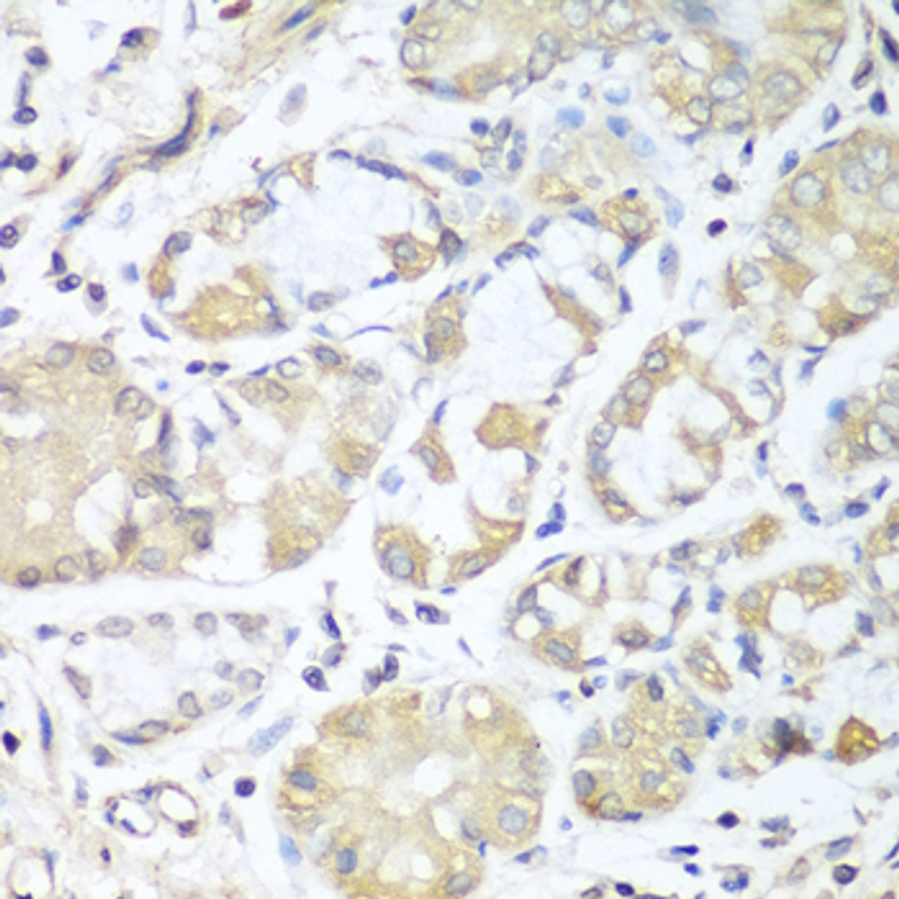 Immunohistochemistry of paraffin-embedded Human stomach using RPH3AL Polyclonal Antibody at dilution of  1:100 (40x lens).