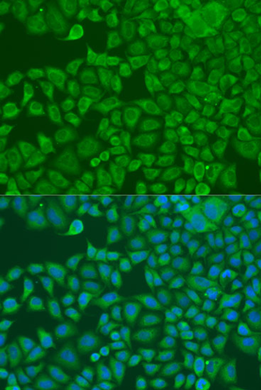 Immunofluorescence analysis of U2OS cells using FXR2 Polyclonal Antibody at dilution of  1:100. Blue: DAPI for nuclear staining.