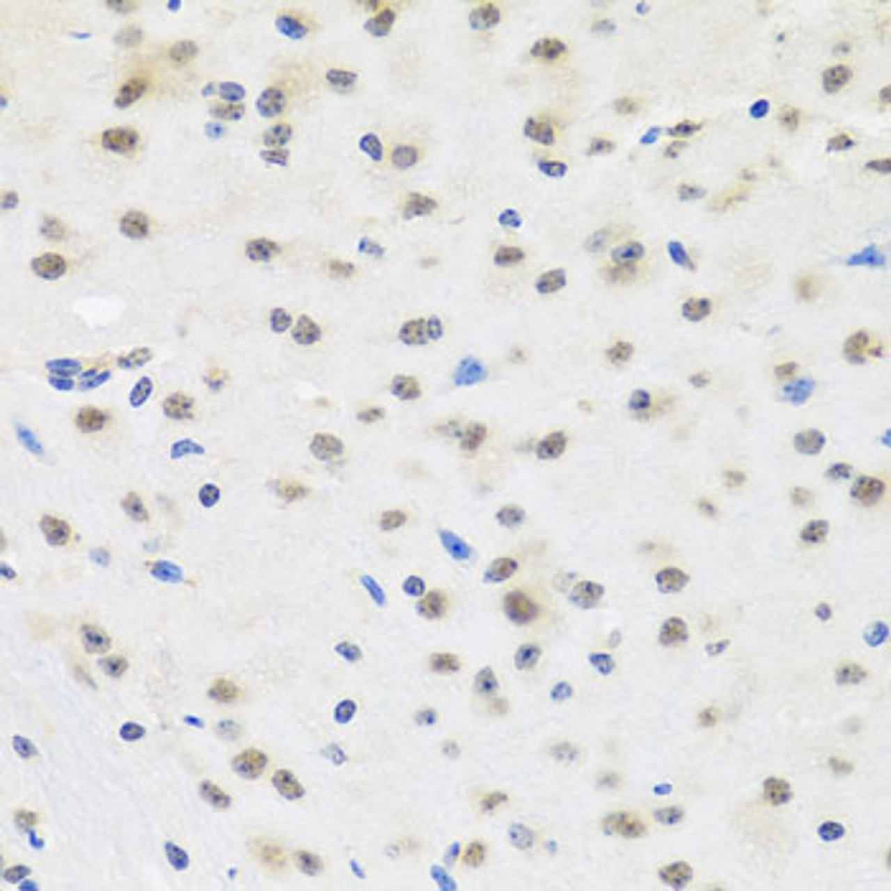 Immunohistochemistry of paraffin-embedded Mouse brain using SAFB2 Polyclonal Antibody at dilution of  1:100 (40x lens).