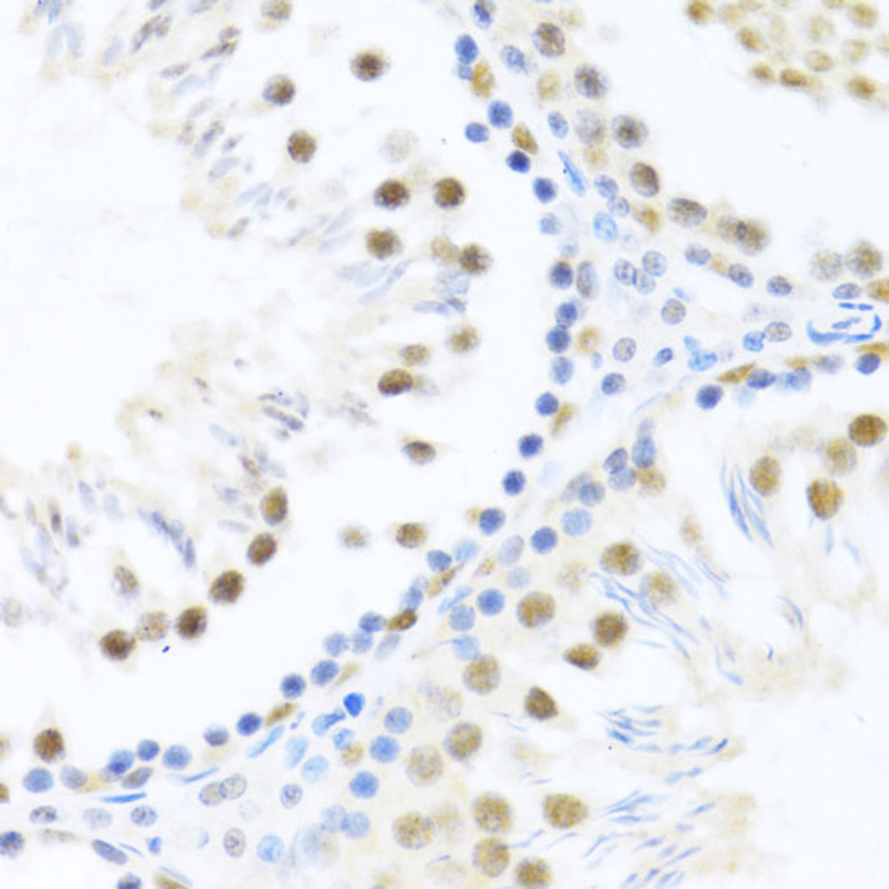 Immunohistochemistry of paraffin-embedded Rat testis using DDX46 Polyclonal Antibody at dilution of  1:100 (40x lens).
