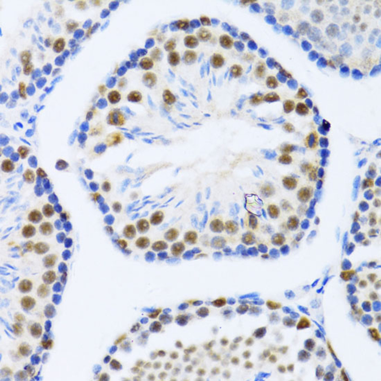 Immunohistochemistry of paraffin-embedded Mouse testis using DDX46 Polyclonal Antibody at dilution of  1:100 (40x lens).