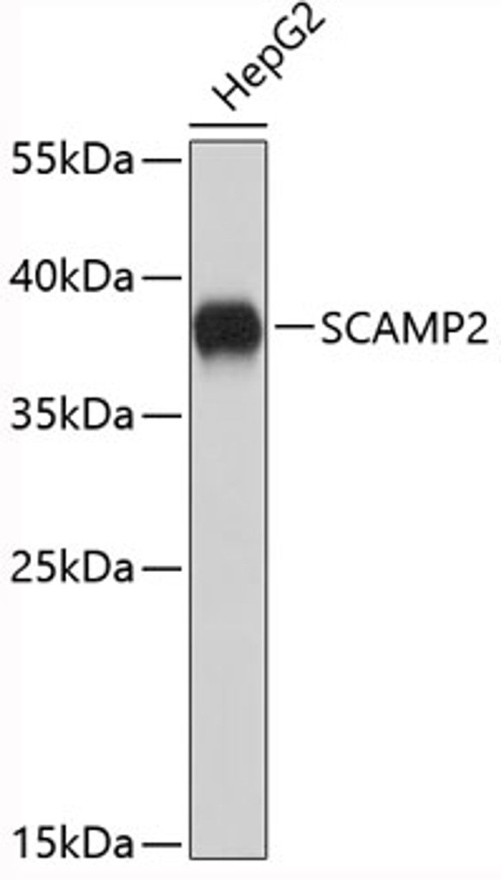 Western blot analysis of extracts of HepG2 cells using SCAMP2 Polyclonal Antibody.