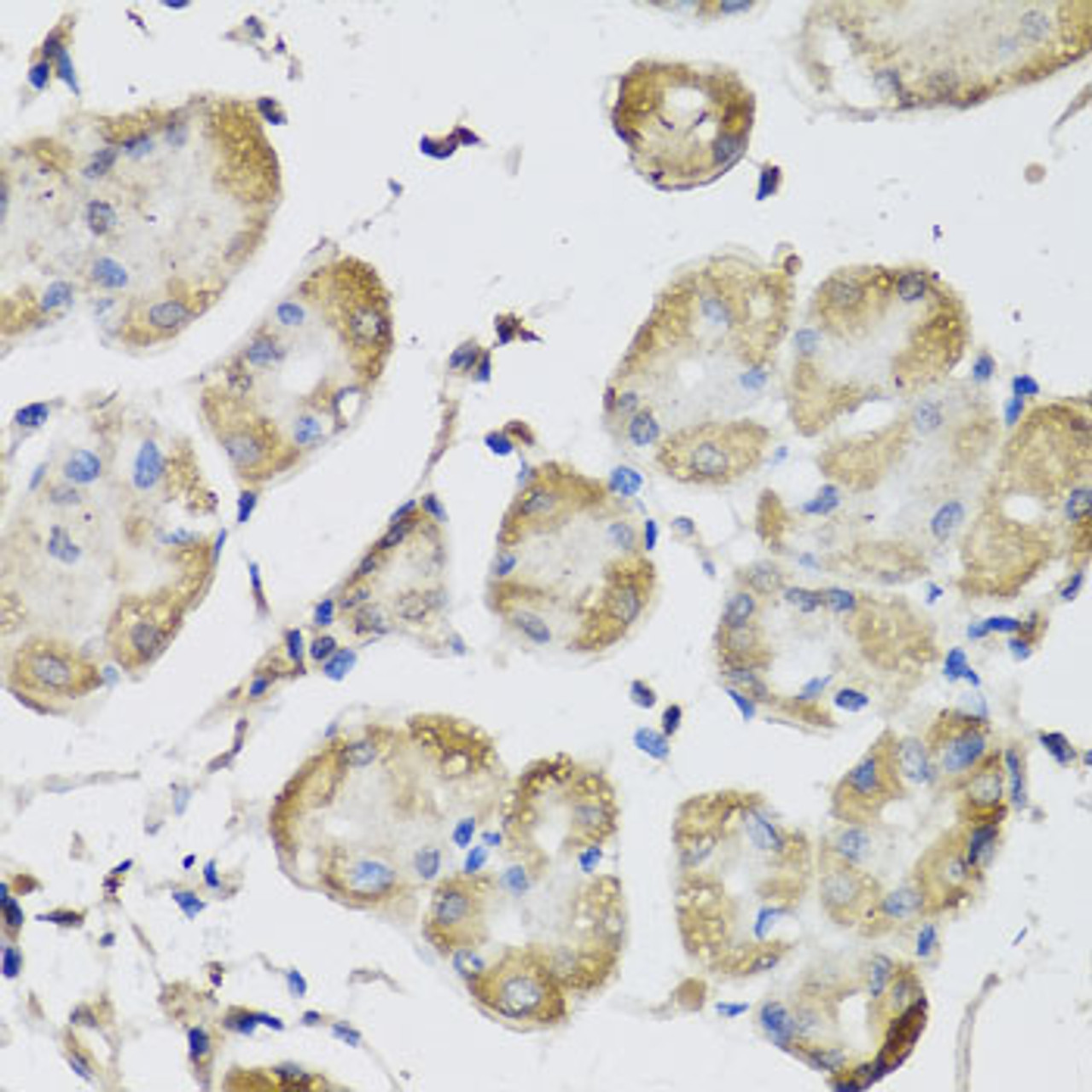 Immunohistochemistry of paraffin-embedded Human stomach using USH1C Polyclonal Antibody at dilution of  1:100 (40x lens).