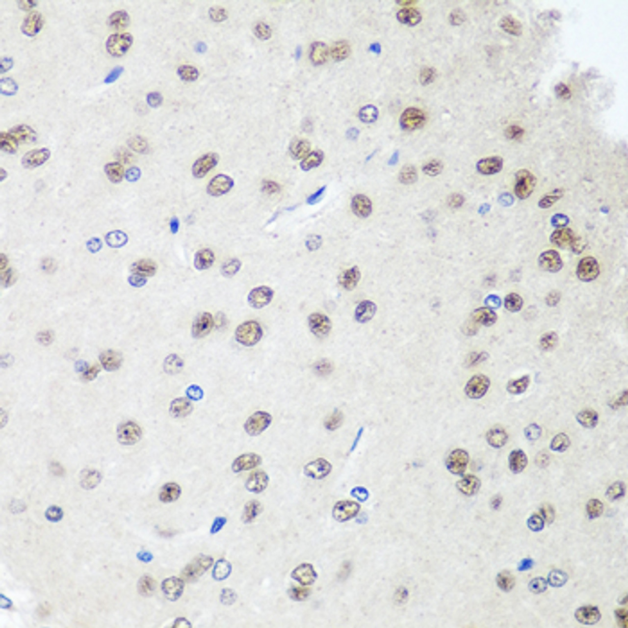 Immunohistochemistry of paraffin-embedded Rat brain using SAP18 Polyclonal Antibody at dilution of  1:100 (40x lens).
