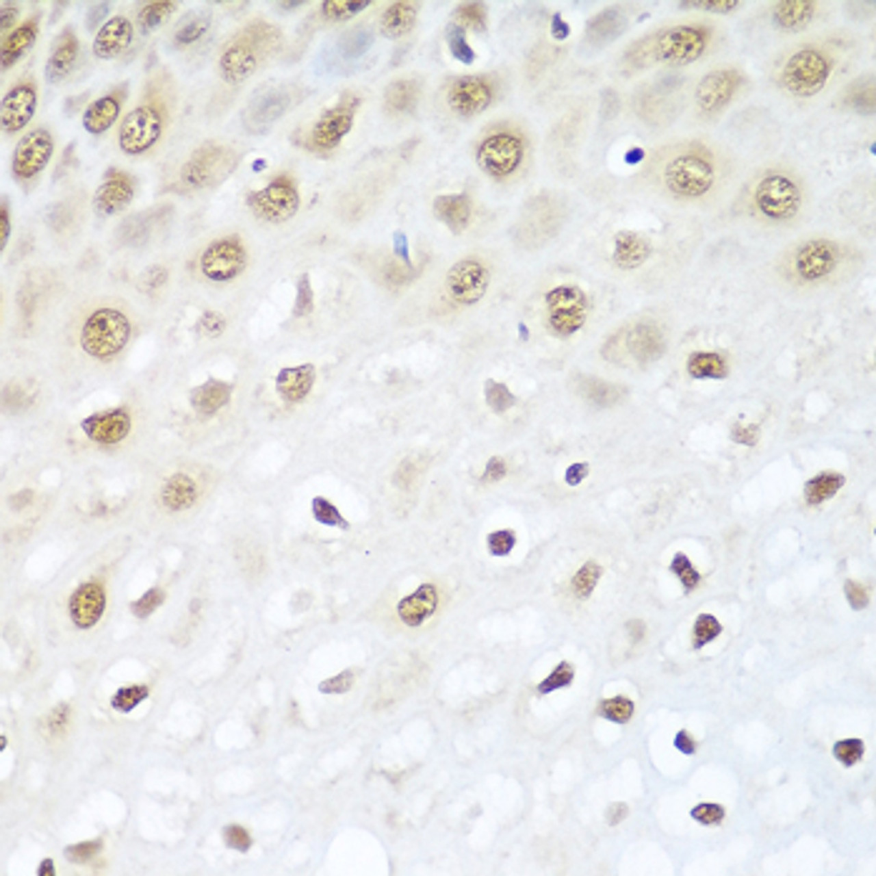 Immunohistochemistry of paraffin-embedded Human esophagus using BCAS2 Polyclonal Antibody at dilution of  1:100 (40x lens).