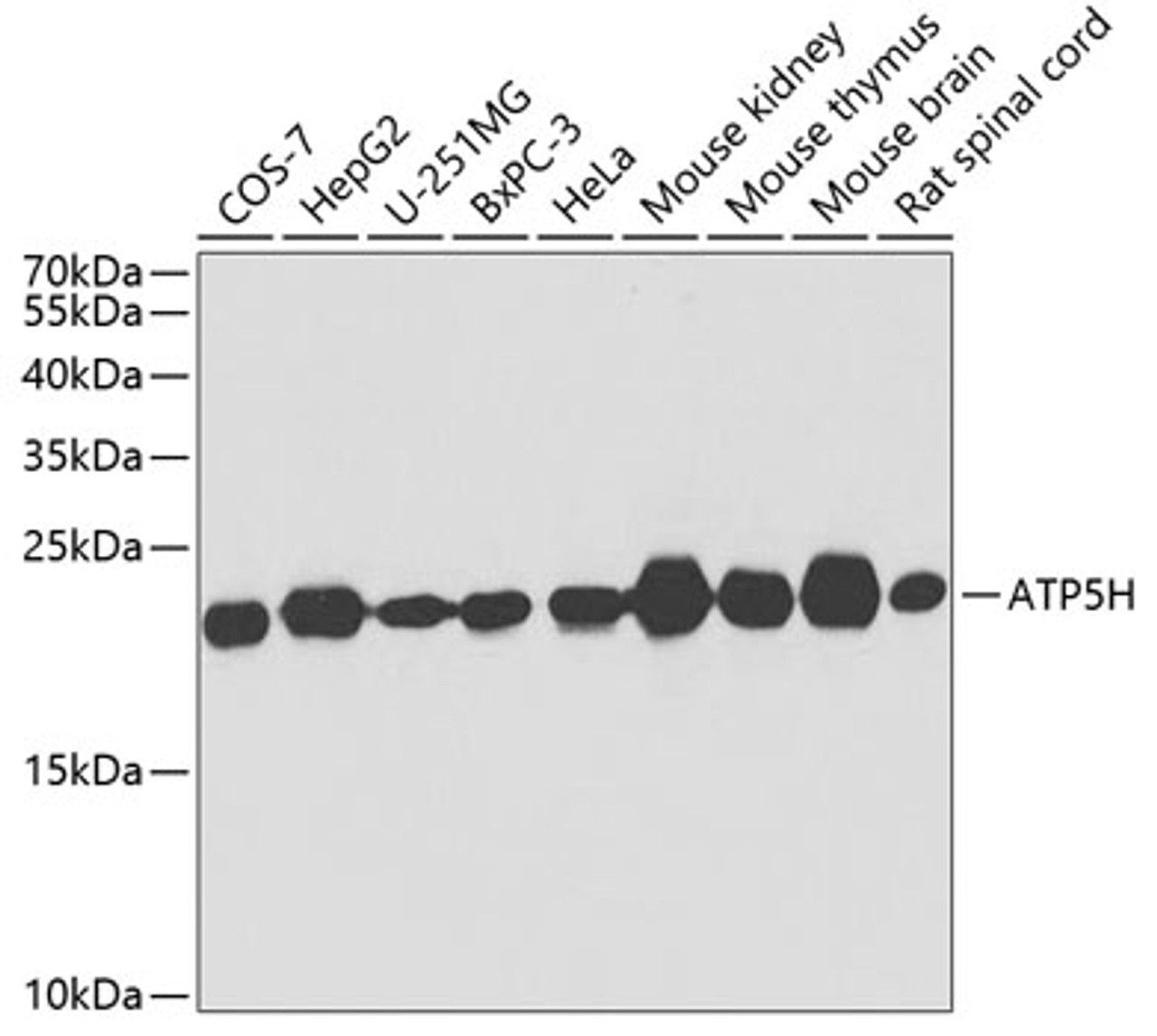 Western blot analysis of extracts of various cell lines using ATP5H Polyclonal Antibody at dilution of 1:1000.