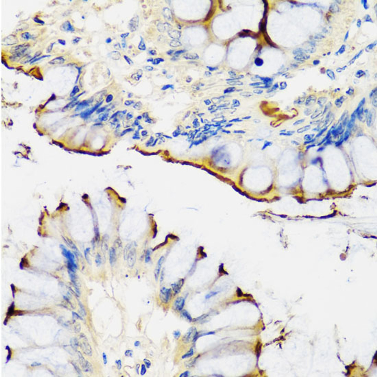 Immunohistochemistry of paraffin-embedded Human colon using CRTAP Polyclonal Antibody at dilution of  1:100 (40x lens).