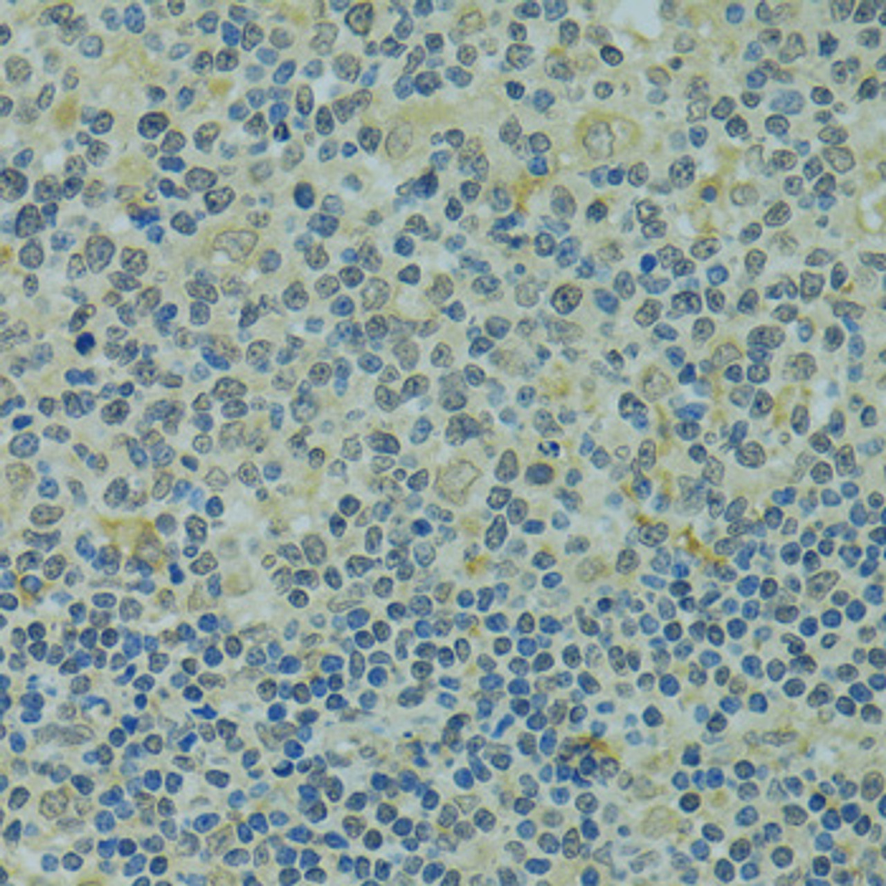 Immunohistochemistry of paraffin-embedded Human tonsil using IVNS1ABP Polyclonal Antibody at dilution of  1:100 (40x lens).
