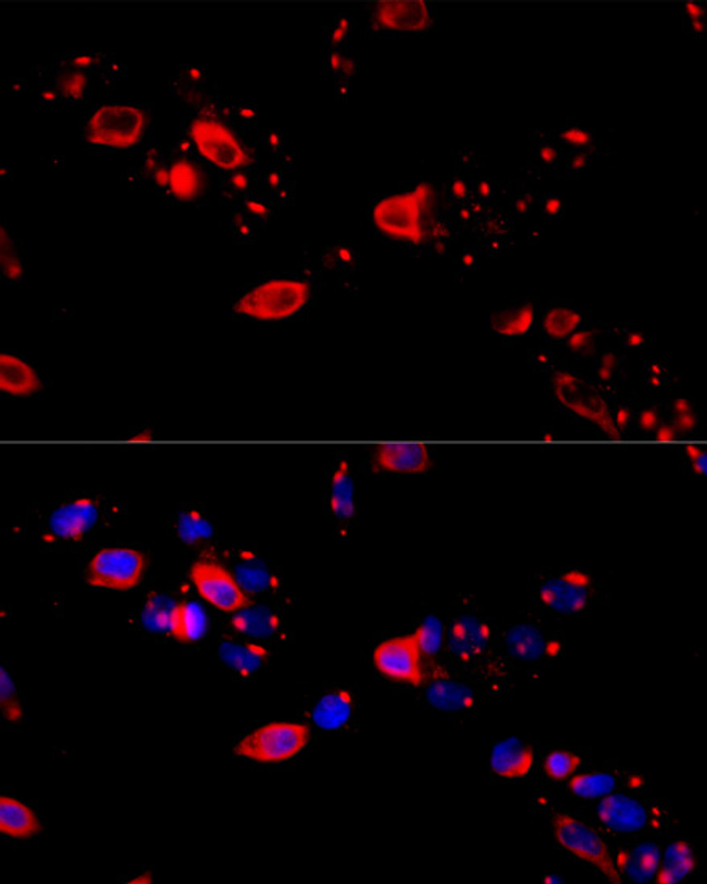 Immunofluorescence analysis of HeLa cells using CCT8 Polyclonal Antibody at dilution of  1:100 (40x lens). Blue: DAPI for nuclear staining.