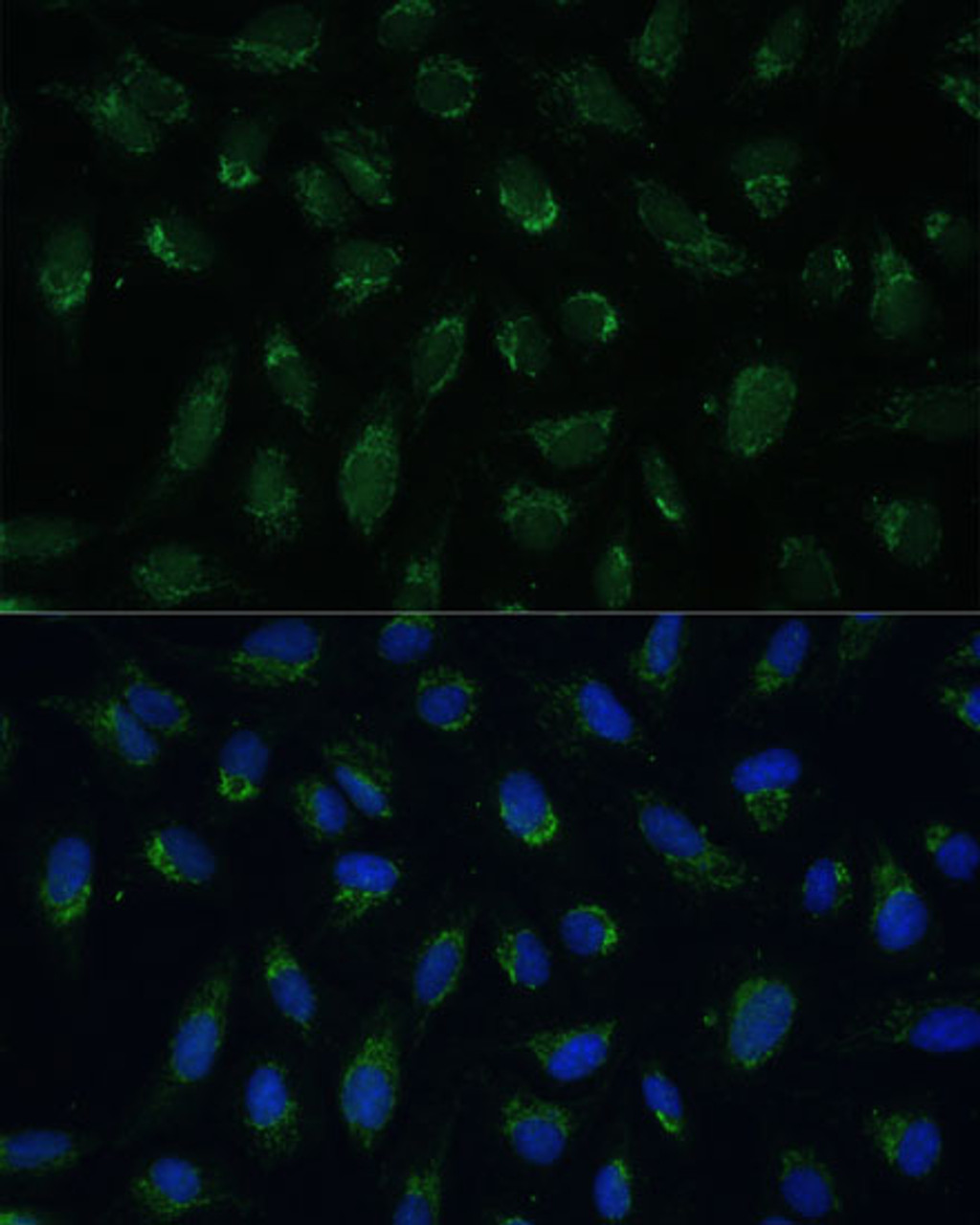 Immunofluorescence analysis of U-2 OS cells using PHB2 Polyclonal Antibody at dilution of  1:100 (40x lens). Blue: DAPI for nuclear staining.