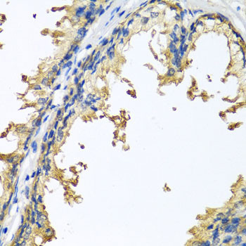 Immunohistochemistry of paraffin-embedded Human prostate using NLGN4Y Polyclonal Antibody at dilution of  1:100 (40x lens).