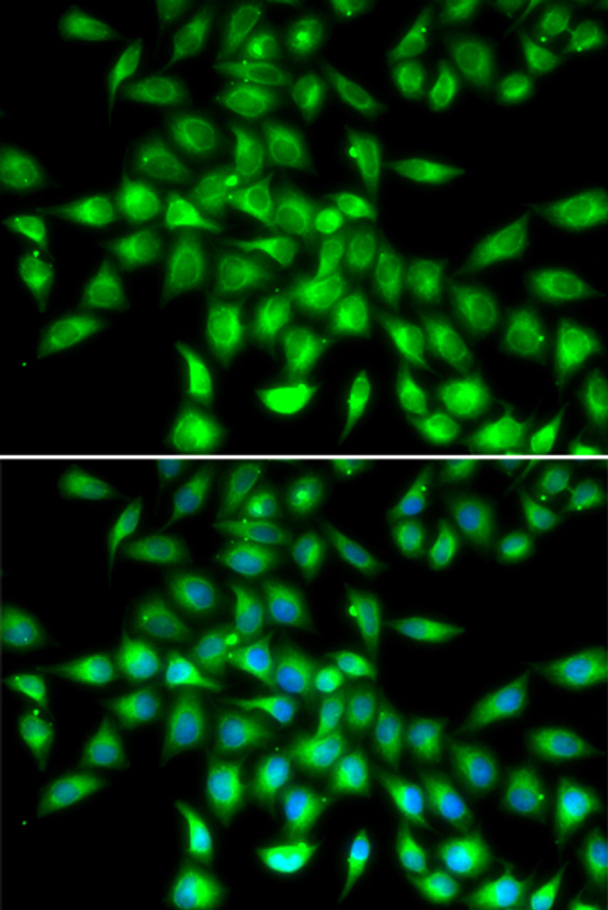 Immunofluorescence analysis of A549 cells using SERPINA10 Polyclonal Antibody