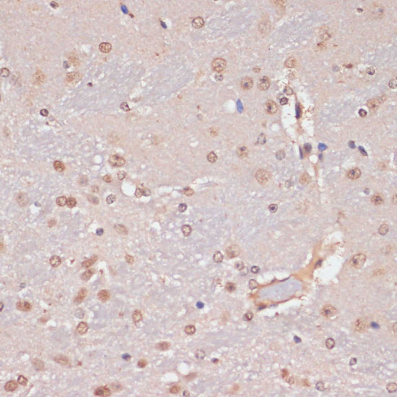 Immunohistochemistry of paraffin-embedded Mouse brain using PIDD Polyclonal Antibody at dilution of  1:100 (40x lens).