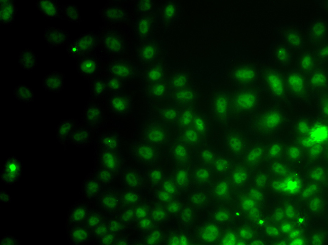 Immunofluorescence analysis of A549 cells using IWS1 Polyclonal Antibody