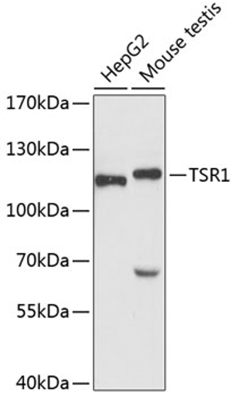 Western blot analysis of extracts of various cell lines using TSR1 Polyclonal Antibody at dilution of 1:3000.