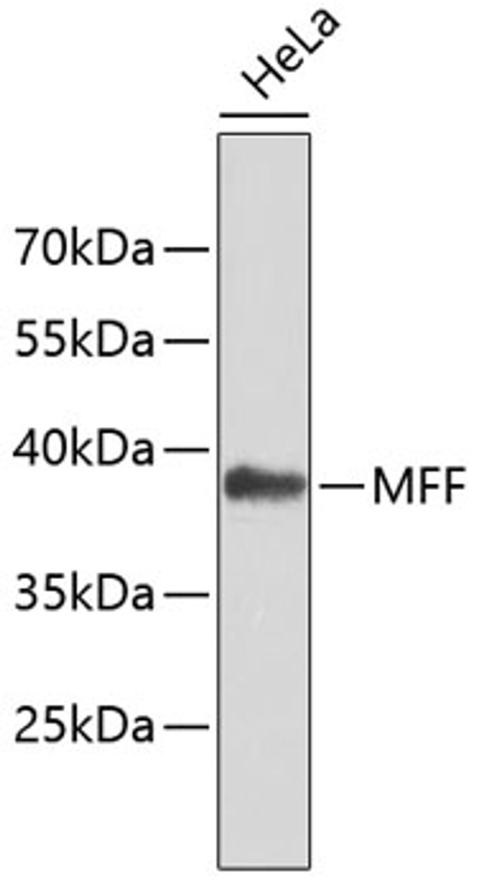 Western blot analysis of extracts of HeLa cells using MFF Polyclonal Antibody.