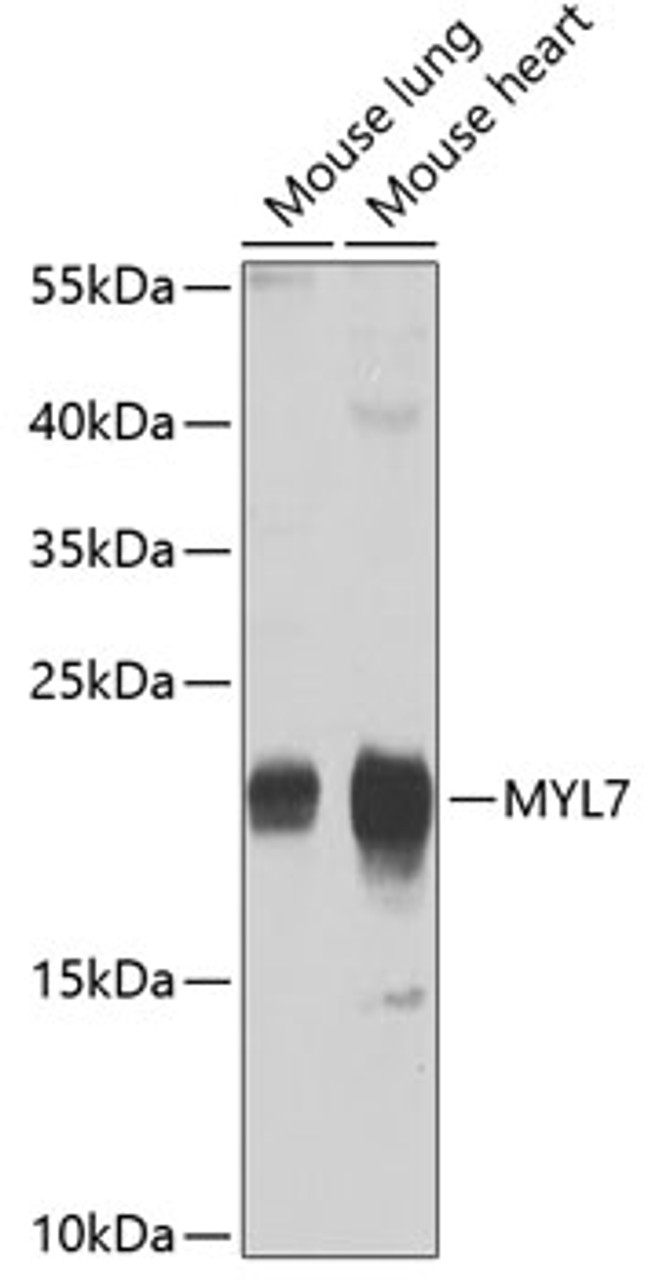 Western blot analysis of extracts of various cell lines using MYL7 Polyclonal Antibody at dilution of 1:1000.