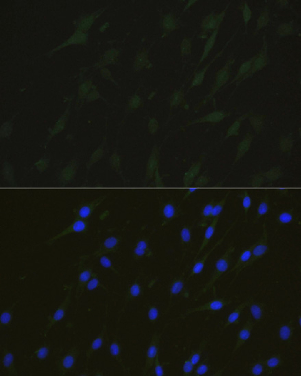 Immunofluorescence analysis of C6 cells using NHEJ1 Polyclonal Antibody at dilution of  1:100. Blue: DAPI for nuclear staining.