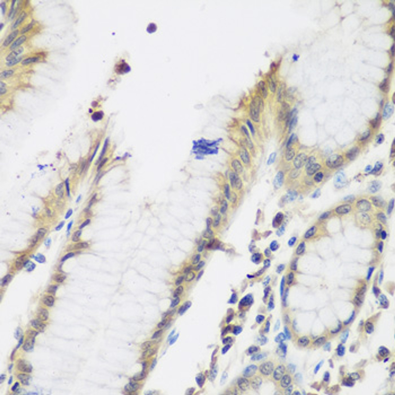 Immunohistochemistry of paraffin-embedded Human stomach using NAA50 Polyclonal Antibody at dilution of  1:200 (40x lens).