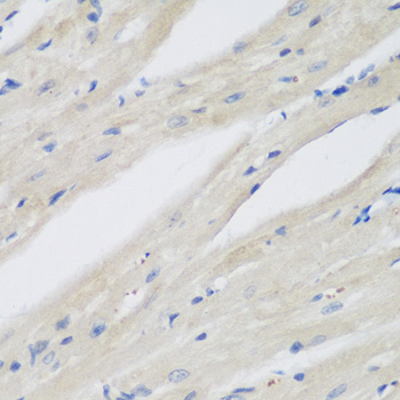 Immunohistochemistry of paraffin-embedded Mouse heart using NAA50 Polyclonal Antibody at dilution of  1:200 (40x lens).