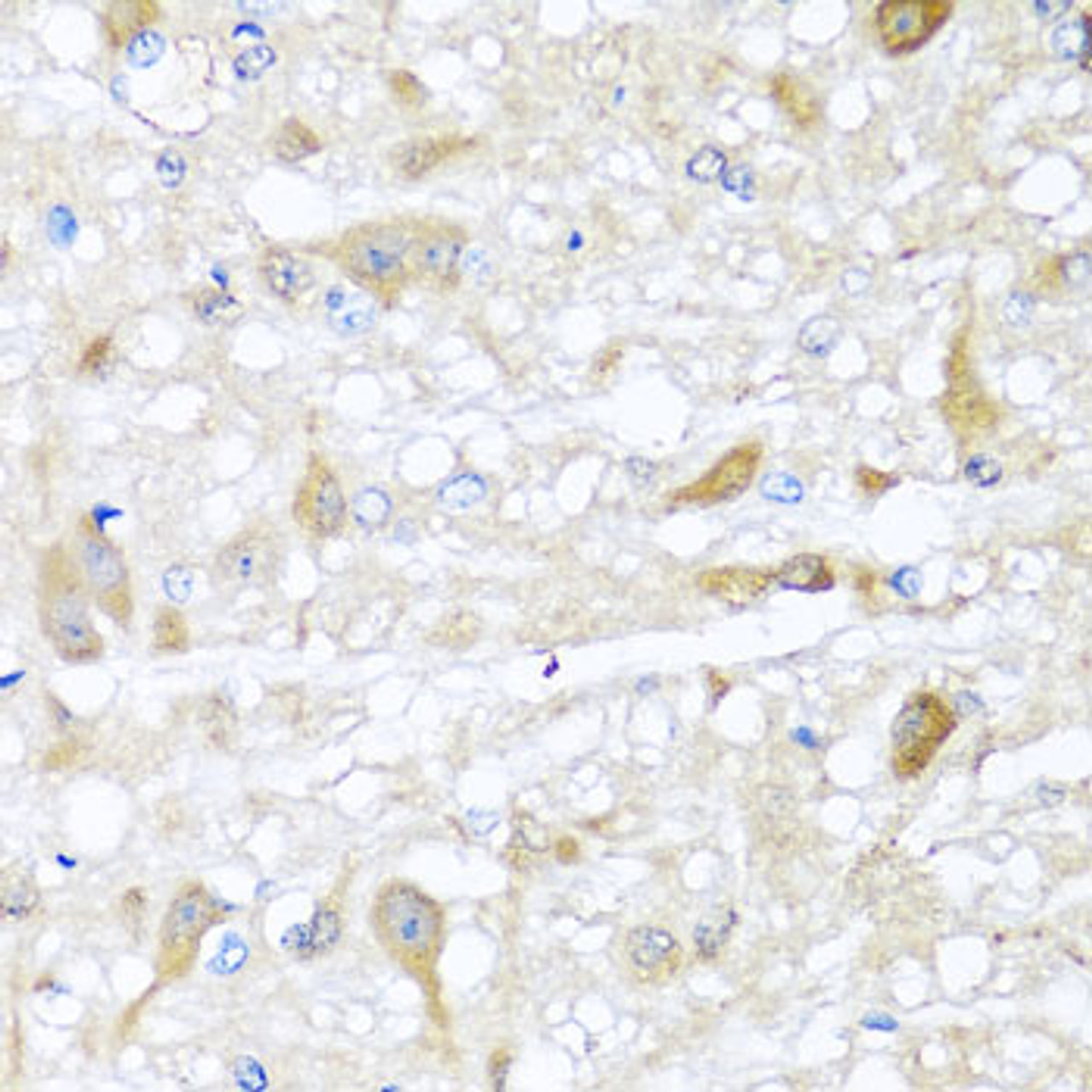 Immunohistochemistry of paraffin-embedded Rat brain using CBR4 Polyclonal Antibody at dilution of  1:100 (40x lens).